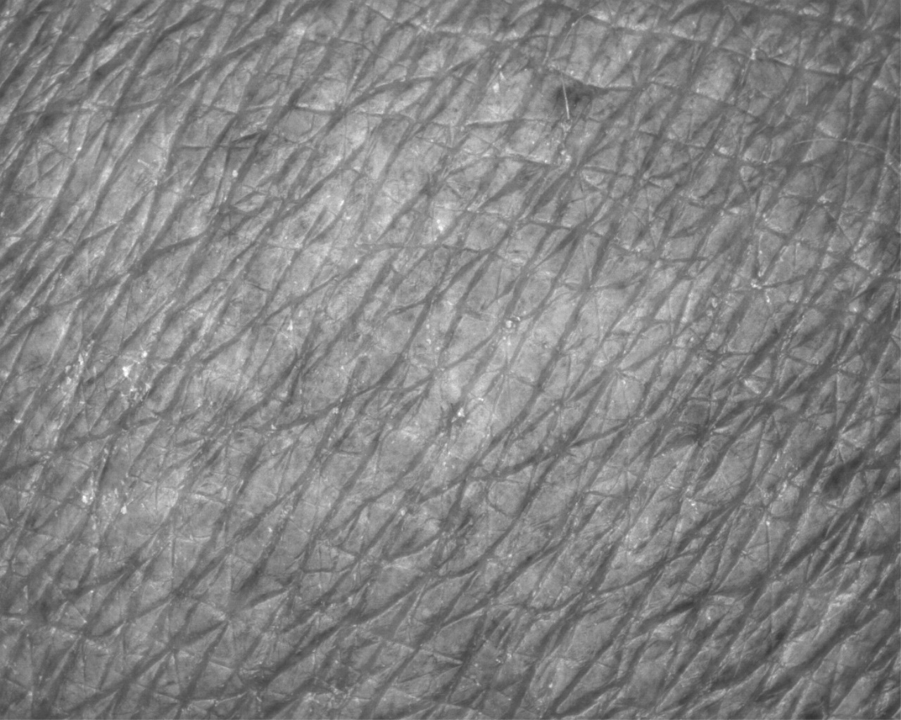 Skin Topography by VisioScan VC 20plus | Skin Roughness Measuring System