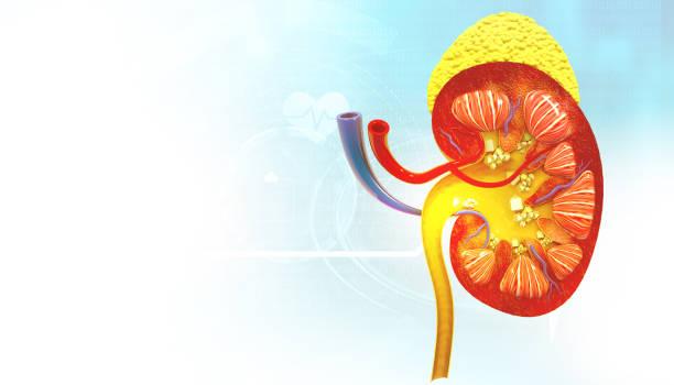 Expert Kidney Stone Treatment at VIMS – Leading Kidney Stone...