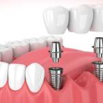 William Kane Profile Picture