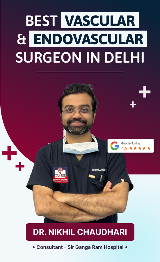 Best Vascular Surgeon In Delhi | Best Endovascular Surgeon In Delhi - Dr. Nikhil Chaudhari