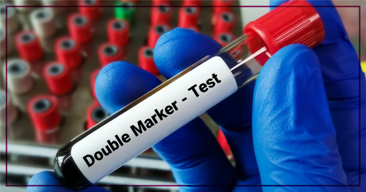 NT Scan in Chandigarh | The Garbh Clinic