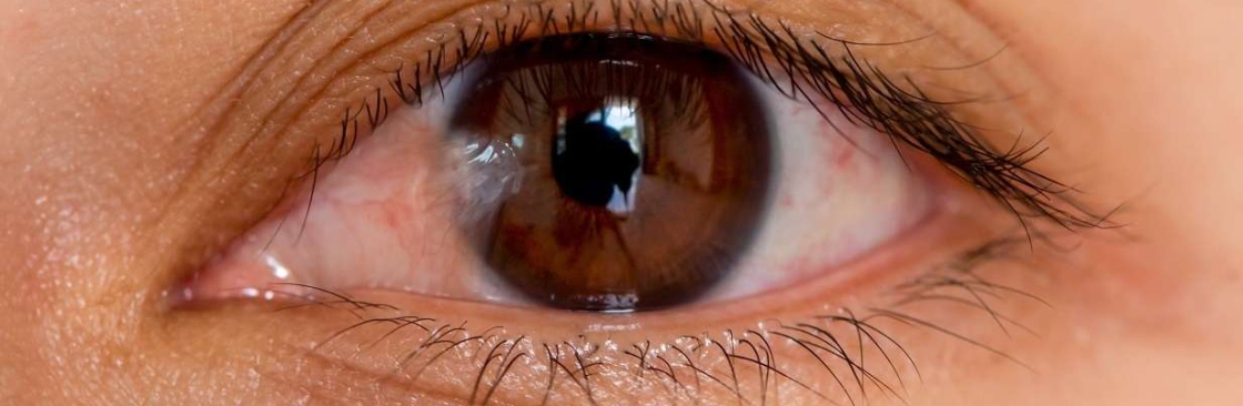 Houston Lasik and Eye Cover Image