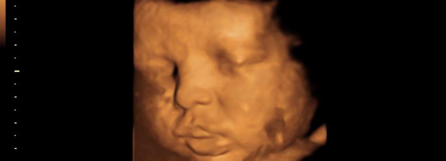 Baby Moments Cover Image