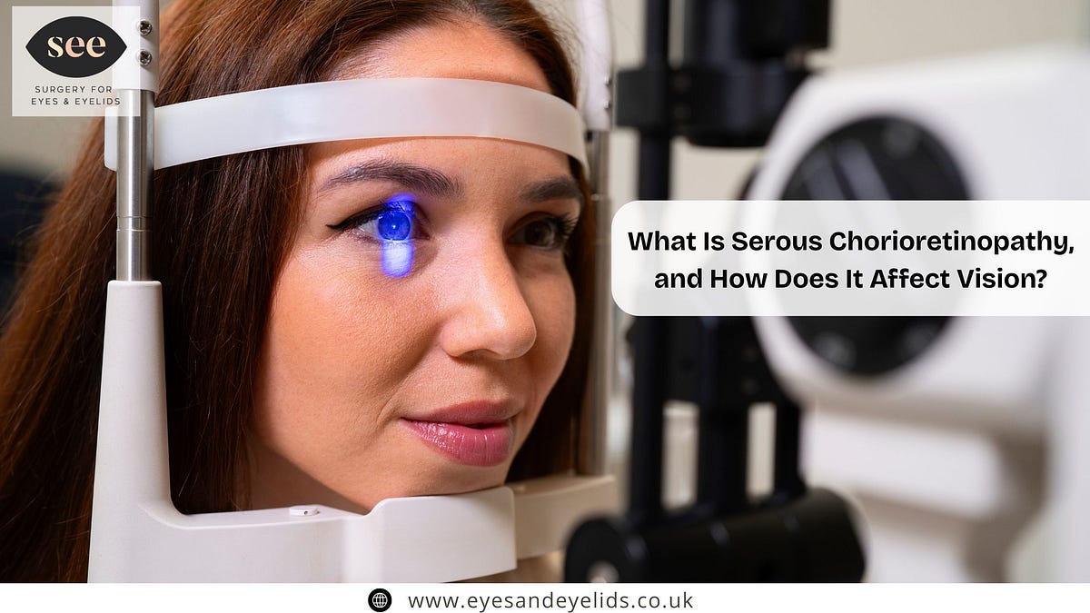 What Is Serous Chorioretinopathy, and How Does It Affect Vision? | by SEE Clinic | Aug, 2025 | Medium