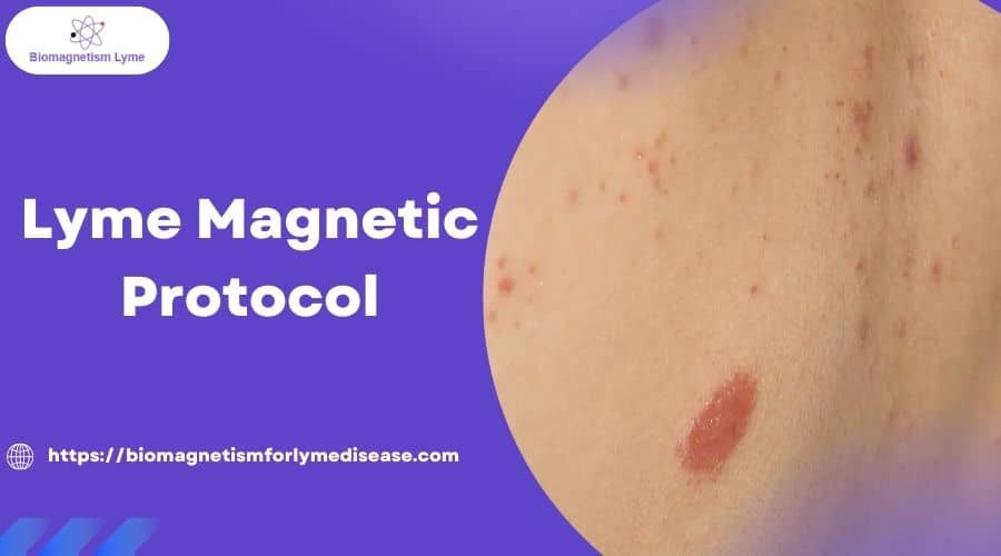 Lyme Magnetic Protocol: Relief from Chronic Lyme Symptoms