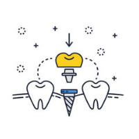 Orthodontics for Children | PDG Dental | Pediatric Dentistry & Orthodontics