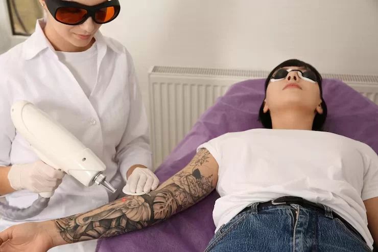 Looking for Cheap Tattoo Removal? Try This Affordable Fix