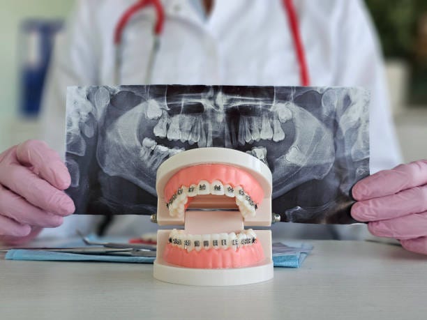 Elevate Your Smile with Expert Orthodontic Care Near Lafayette | by Ascend Orthodontics | Sep, 2025 | Medium