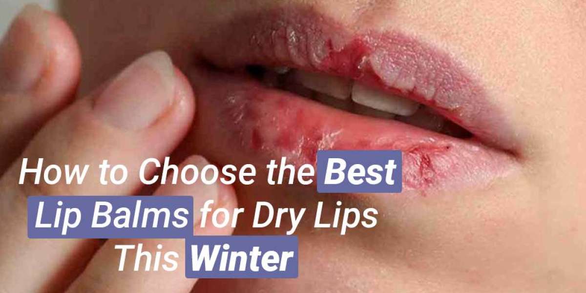 How to Choose the Best Lip Balms for Dry Lips This Winter