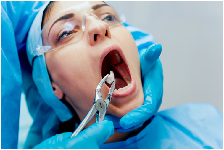 Wisdom Tooth Woes? Breaking Down Wisdom Tooth Removal Costs in Al Ain