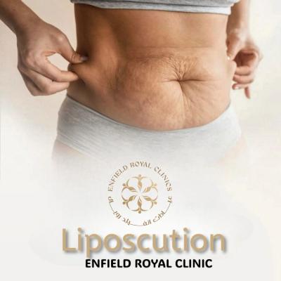 Liposuction in Islamabad – Arms, Thighs & Abdomen | ERCs