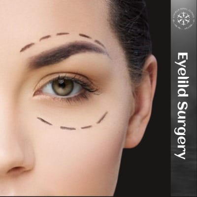 Eyelid Surgery & Blepharoplasty in Islamabad