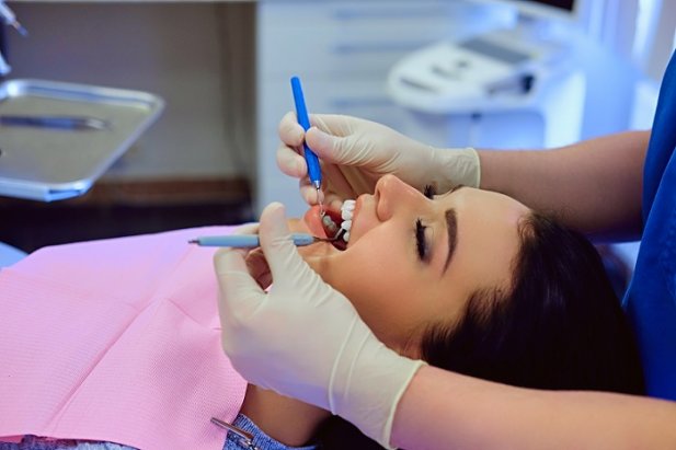Thinking About Teeth Whitening in Dublin? Here’s Everything You Need to Know Article - ArticleTed -  News and Articles