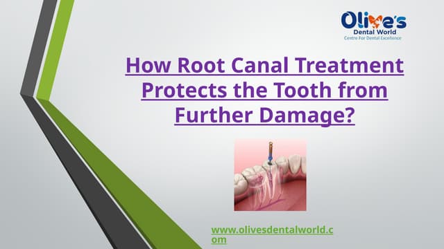 How Root Canal Treatment Protects the Tooth from Further Damage? | PPTX