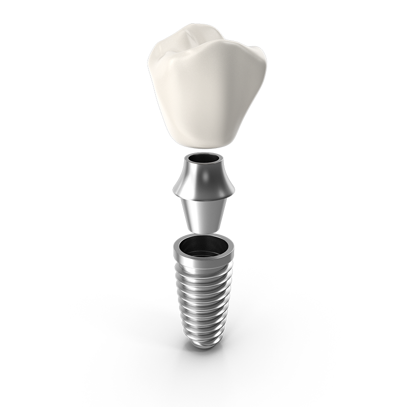 Expert Dental Implants in Louisville KY | 502 ORAL SURGERY