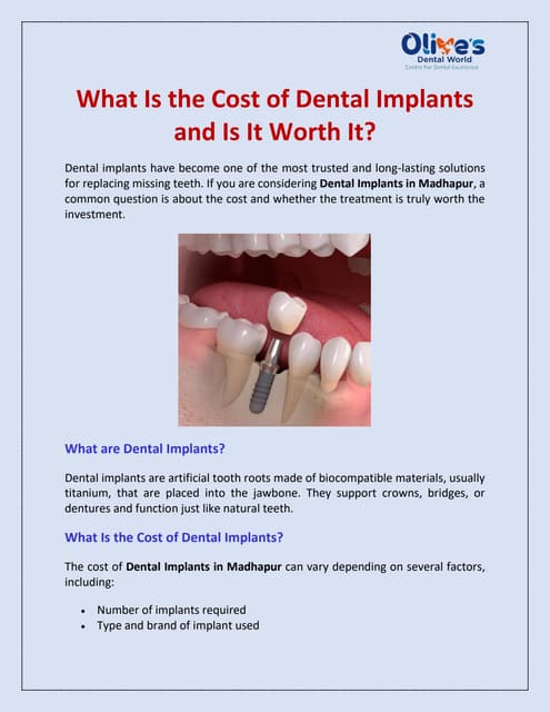 What Is the Cost of Dental Implants and Is It Worth It? | PDF