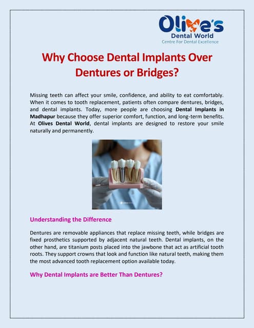 Why Choose Dental Implants Over Dentures or Bridges.pdf