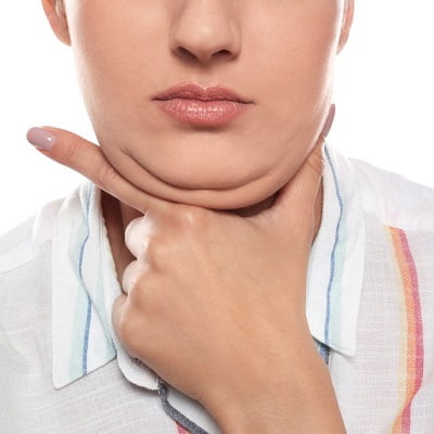 Double Chin Treatment in Pakistan| Double Chin in Islamabad