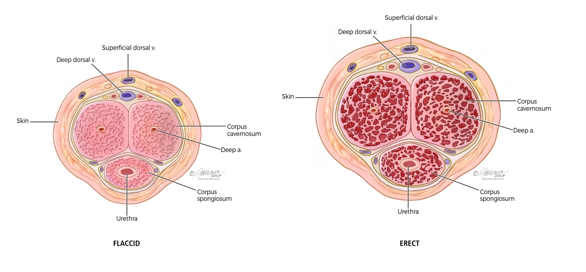 Is Erectile Dysfunction Affecting You in Parsippany? Here's Where to Get Real Help