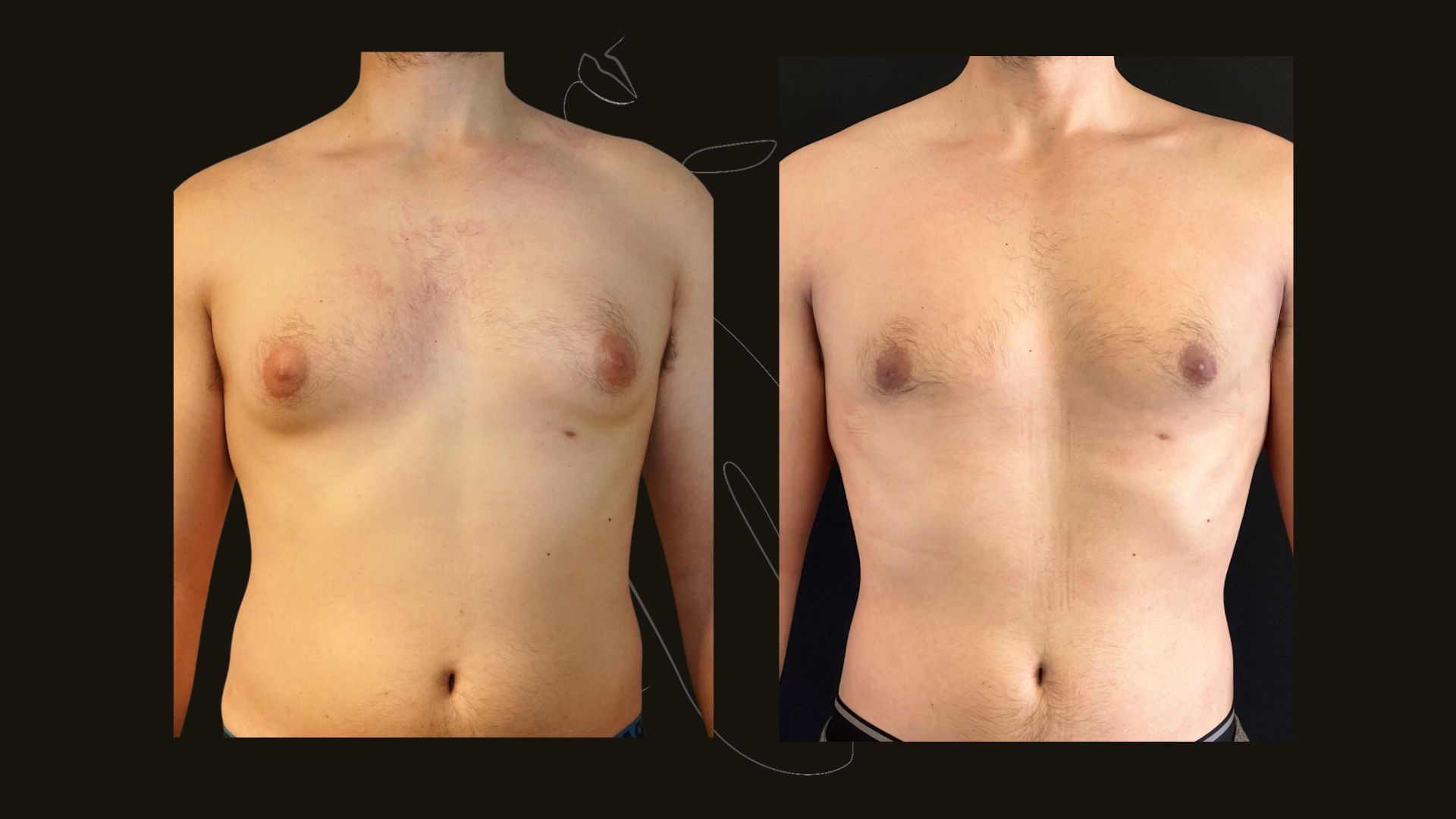 Top NYC Plastic Surgery Procedures | Dr. Itay Wiser