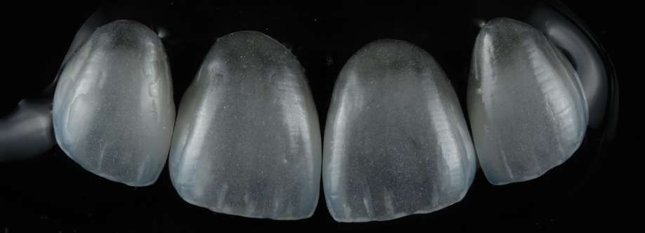 premium zahnimplantate Wien Cover Image