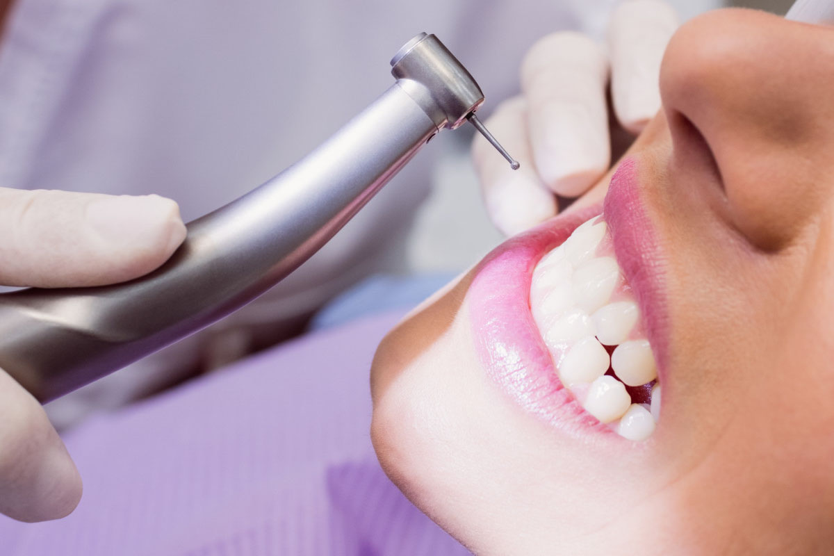 Dental Crowns in Mississauga | Restore & Protect Your Teeth
