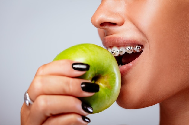 Eating With Dental Braces: Foods You Can and Cannot Eat