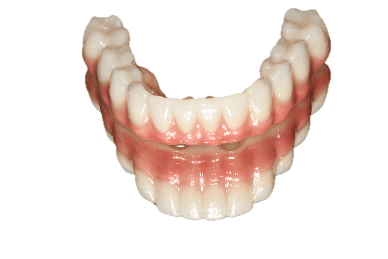 All On X Dental Implants in Bethlehem at Bright Dental