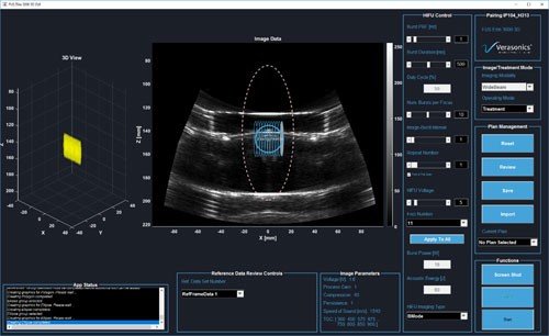 Advanced Focused Ultrasound Solutions for Precisio..