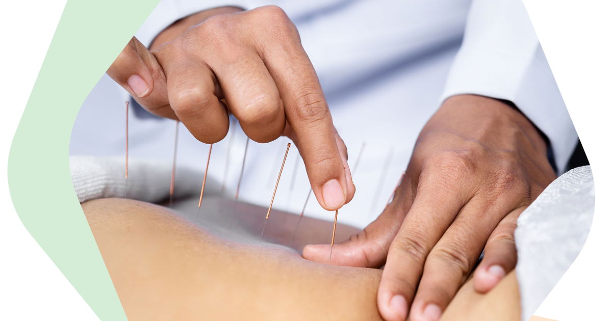 Acupuncture Calgary: Effective Support for Headaches and Migraines