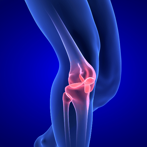 Arthritis Treatment Orange County, Hip Pain Therapy California