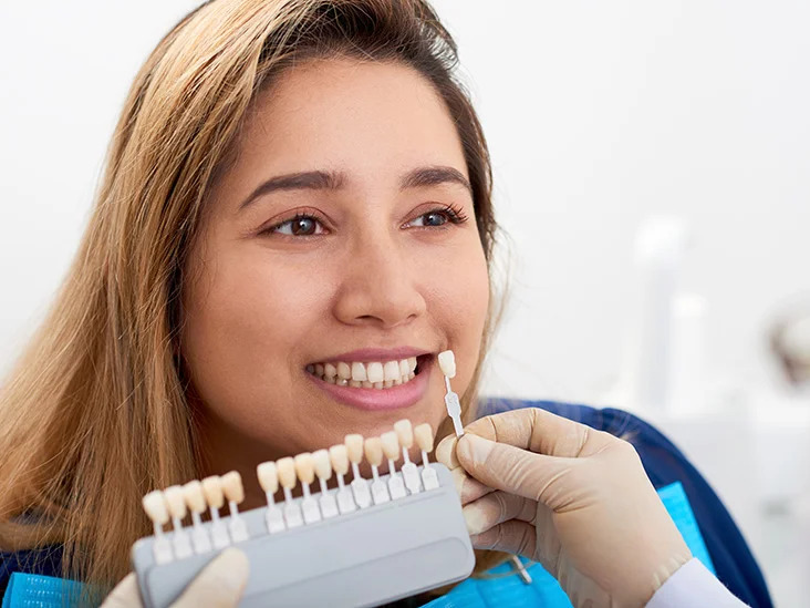 Dental Veneers vs Dental Crowns: Understanding the Differences | NEXTO