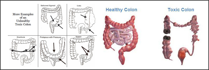 What to Expect During a Colon Hydrotherapy Session