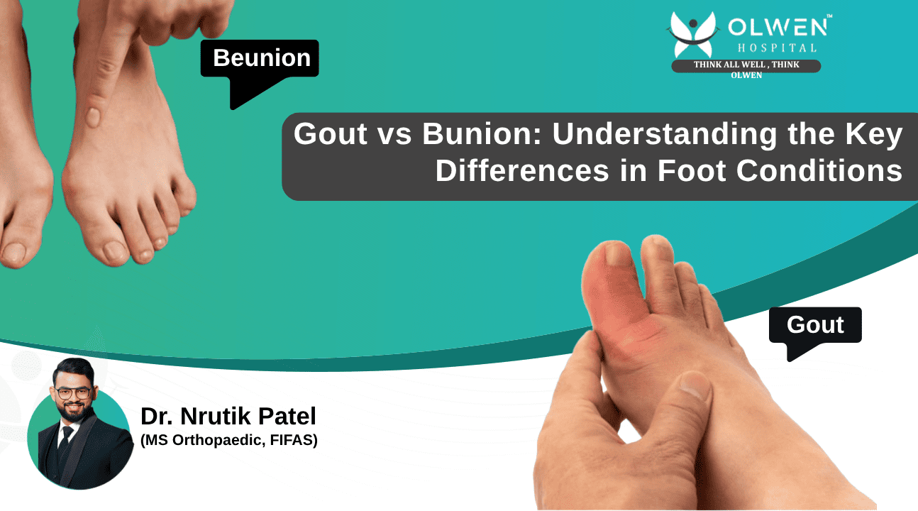 Gout vs Bunion: Key Differences | Orthopedic Surgeons in Ahmedabad