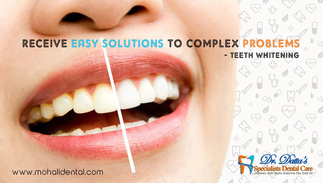 Affordable Teeth Whitening Treatment In Mohali - Specialists Dental Care