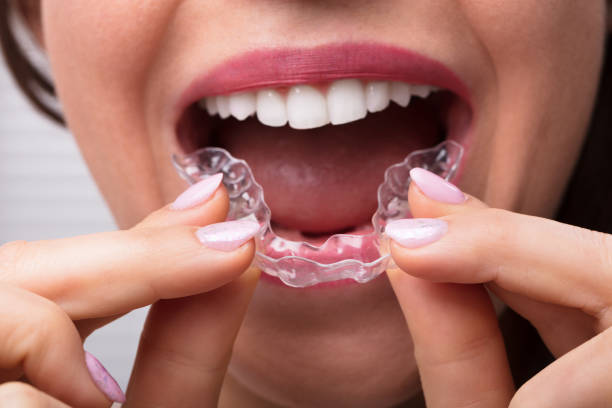 Top Reasons to Consider Invisalign in Traverse City – Traverse City Orthodontics