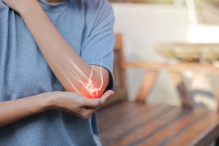 Physiotherapy Exercises for Tennis Elbow Recovery: A Practical Self-Help Guide